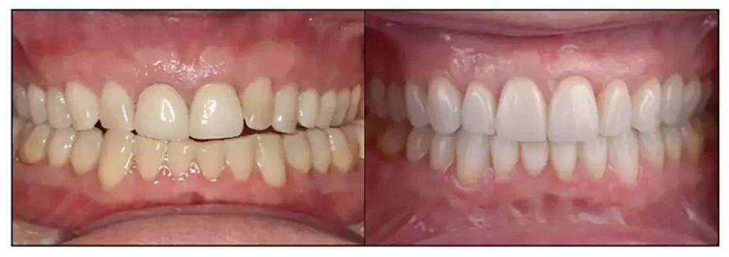 smile transformation 4 1536x543 1