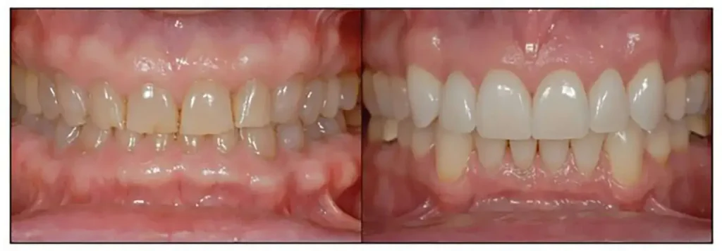 smile transformation 5 1536x534 1