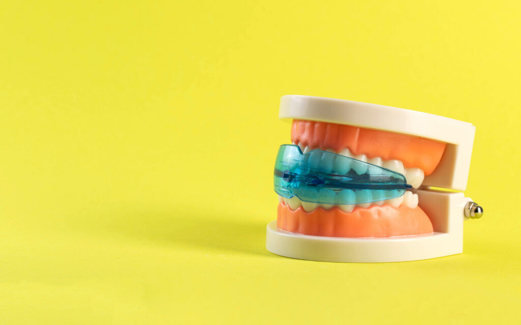 Dental mouth guard for bruxism with a mock-up of a dental jaw on a yellow background. Concept for treatment and protection of teeth from grinding during sleep in children. Copy space for text, silicone pad